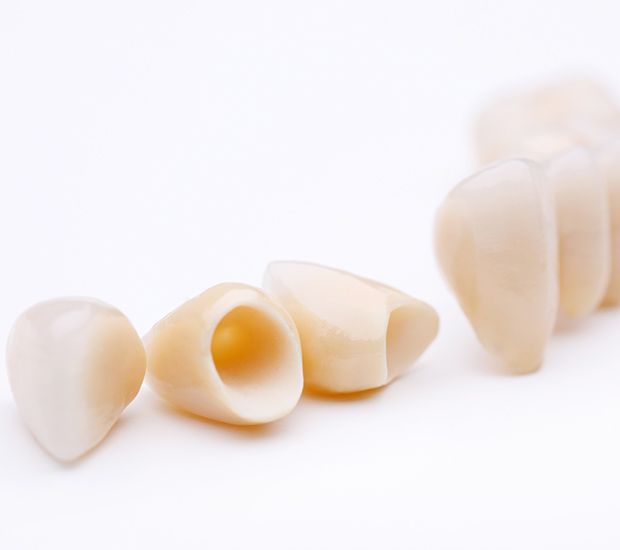 Las Vegas Dental Crowns and Dental Bridges