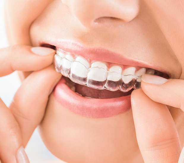 Las Vegas Does Invisalign Really Work